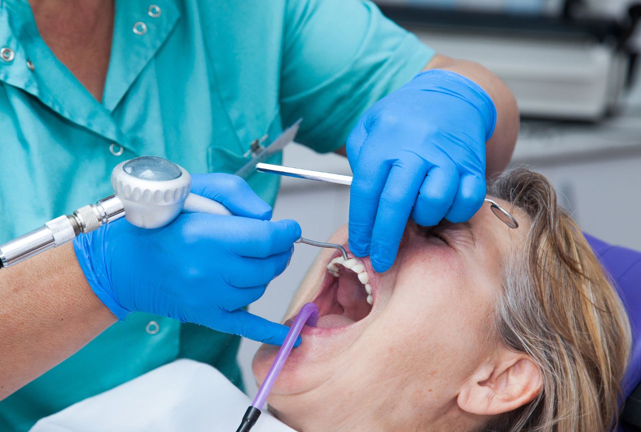 Greffe gingivale | Clinique dentaire Petite-Patrie dans Rosemont