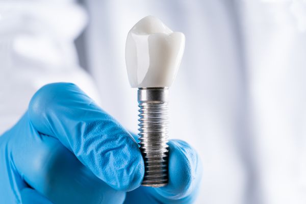Implant dentaire Retrouvez votre sourire naturellement - Clinique dentaire Petite-Patrie